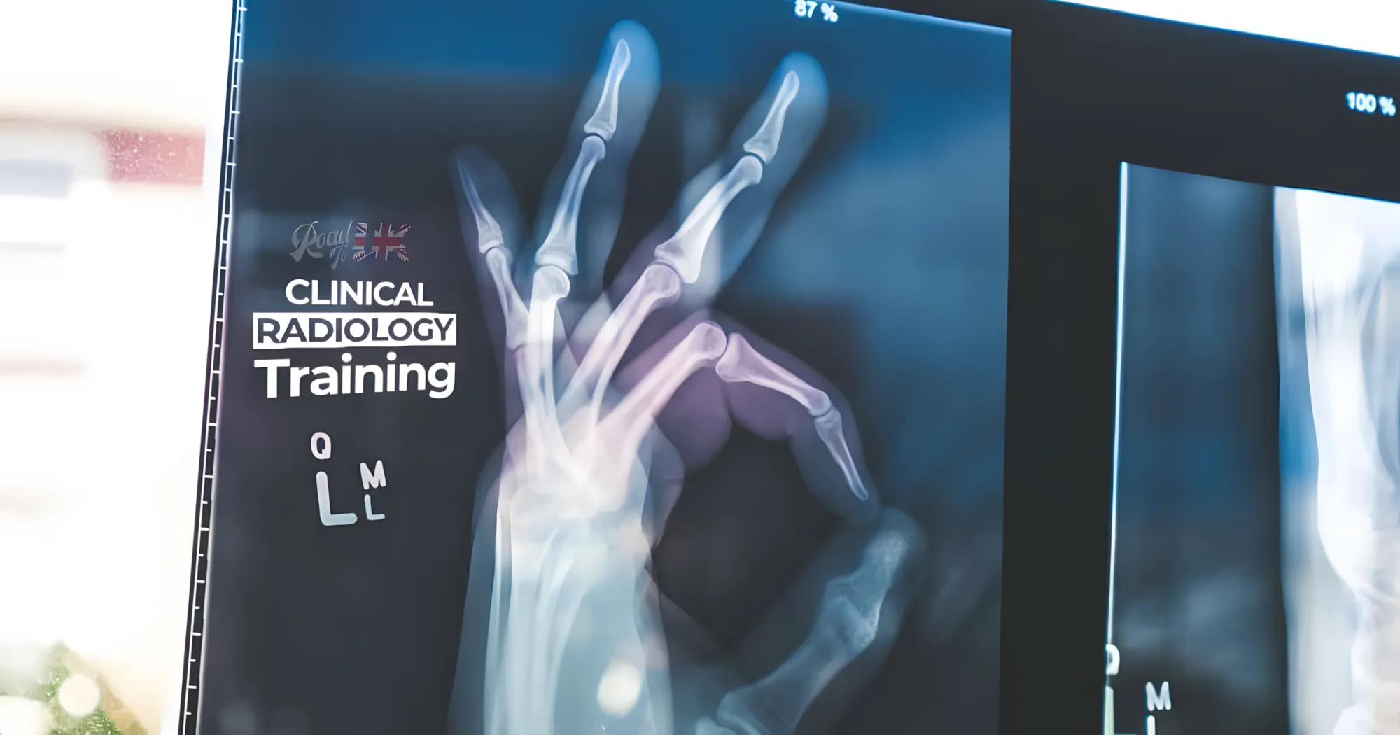 Specialty Training in Clinical Radiology in the UK