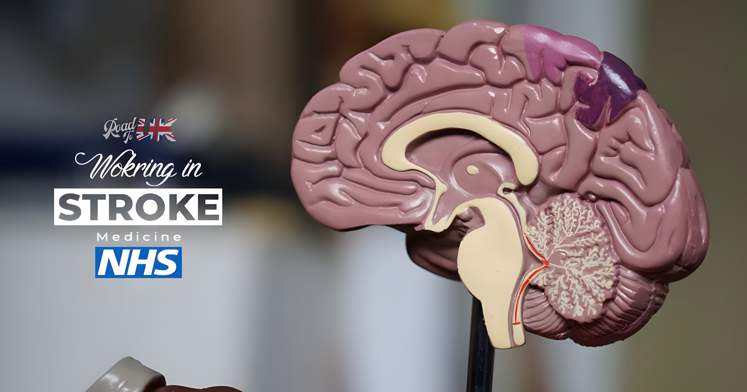 Working in Stroke Medicine in the NHS